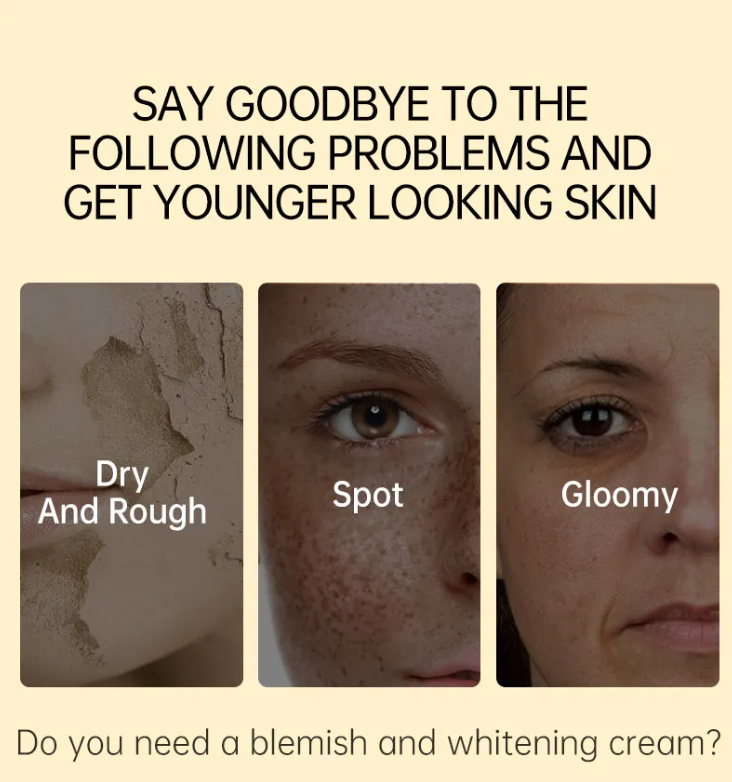 JellyPrim Vitamin C Whitening Face Cream Fading Melasma Dark Spots Acne Marks Moisturiser Non-Greasy Niacinamide Brightening Anti Aging Moisturizing Creams Beauty Skincare 45g