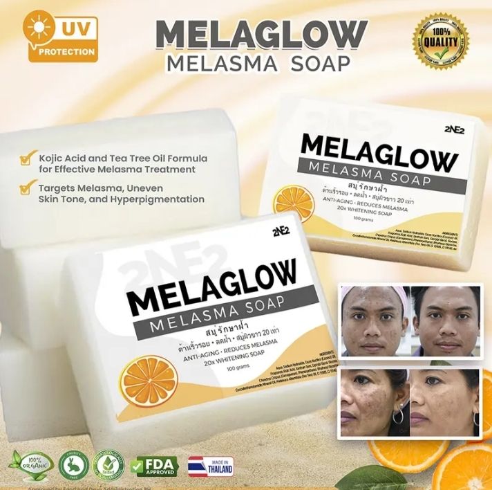glutathione soap melasma Melaglow Soap: Gentle Care for Melasma-Prone Skin Melasma & Dark Spot Skin