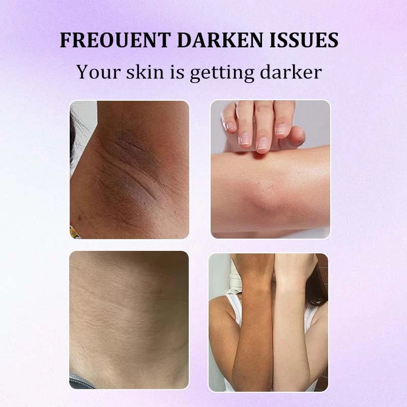 VGO 50X Underarm Whitening Body Cream Underarm Odor Remover Deodorant Inguinal Whitening Cream Underarm Neck Inner Thigh And Bikini Area Whitening Cream 40g