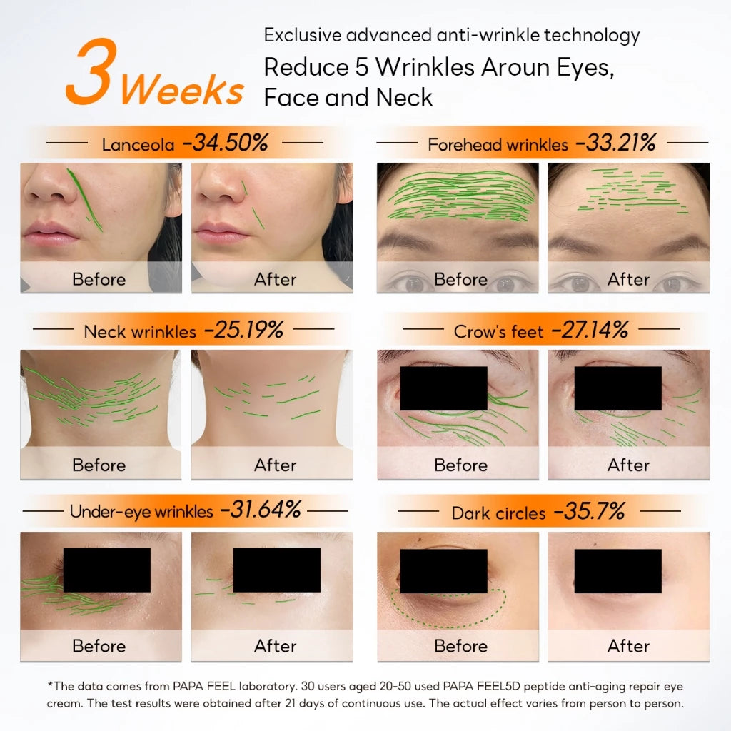 PAPA FEEL Eye Cream 15g eyebag remover | dark circles | anti aging | 5D PEPTIDE eye balm eye care
