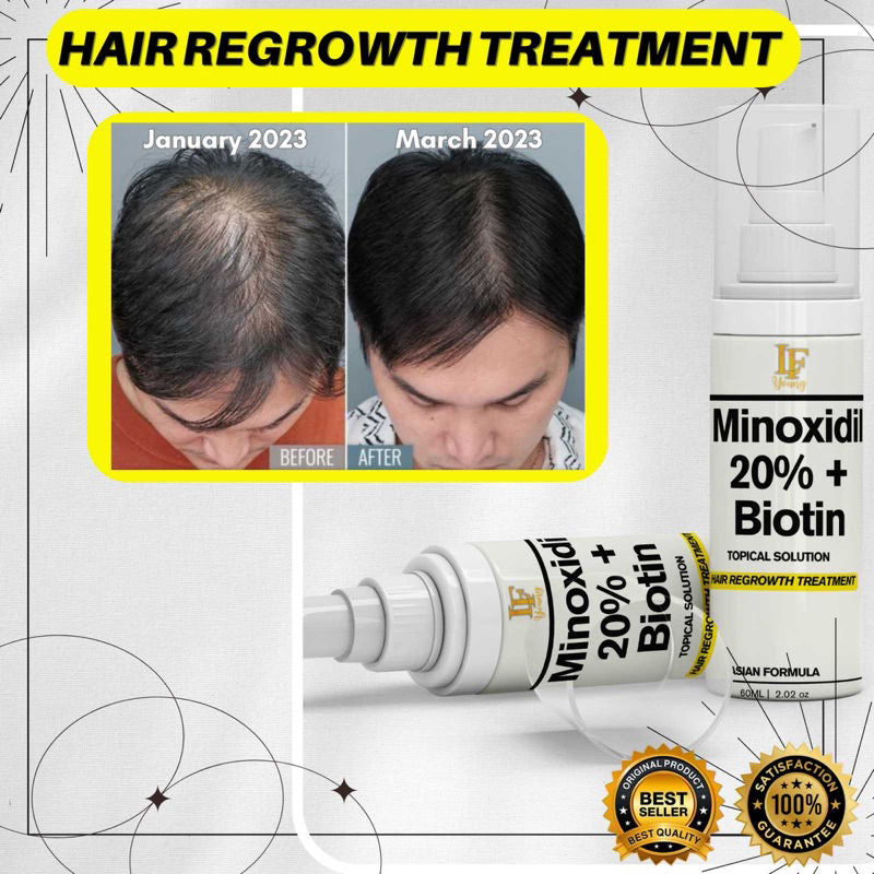Minoxidil Shampoo + Solution Bundle Minoxidil Hairgrower Shampoo 250mL and Spray Solution 60mL for Hair Loss Treatment
