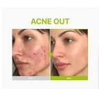 Purito Azelaic Acid 10 Kojic Tea Tree Serum 30ml