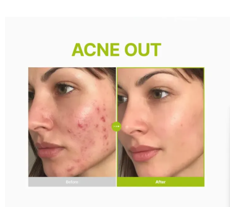 Purito Azelaic Acid 10 Kojic Tea Tree Serum 30ml