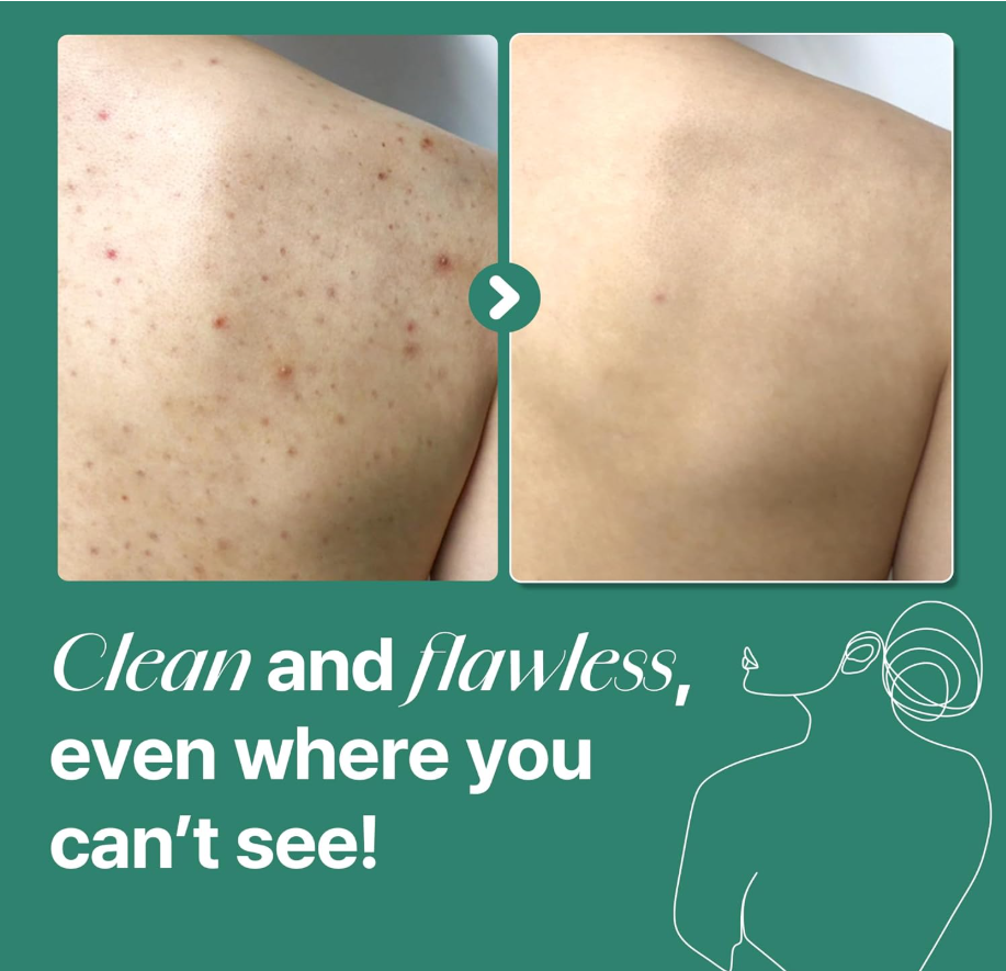 SOME BY MI - AHA, BHA, PHA 30 Days Miracle Acne Clear Body Cleanser