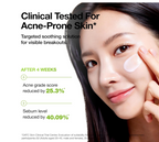 Anua Azelaic Acid CICA Skin Soothing Moisturizer, Lightweight & Redness Relief,