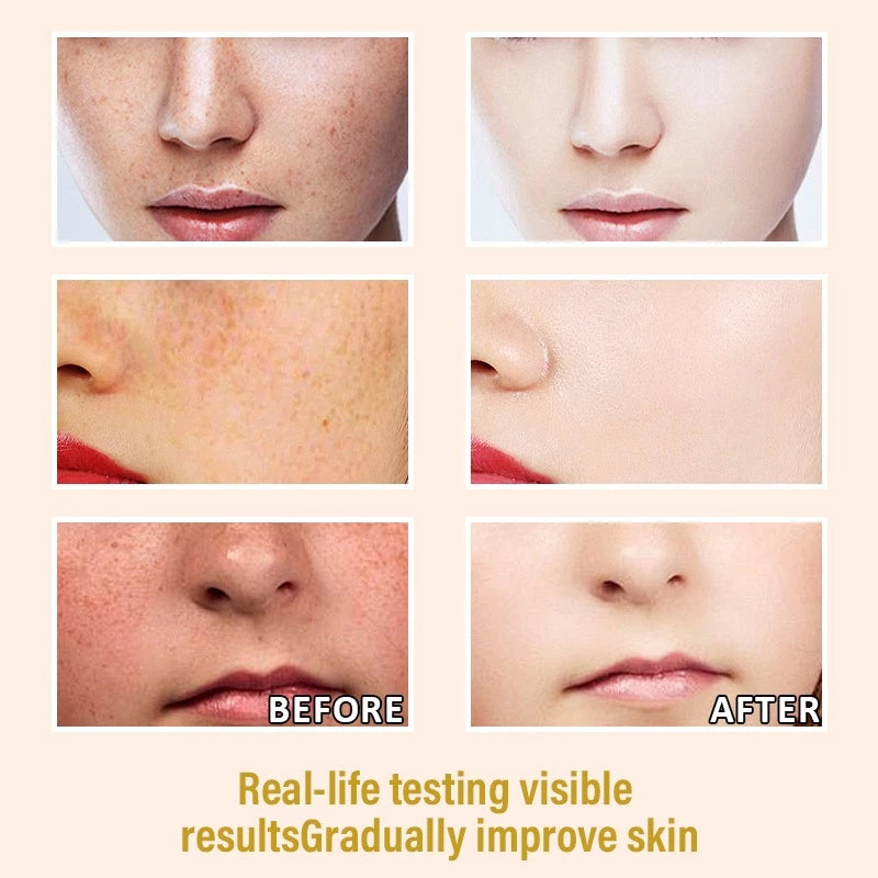 VGO Niacinamide Deeply Clear Anti Melasma Remover Cream Original Facial Whitening Cream for Melasma Dark Spot Remover 20g/0.70oz