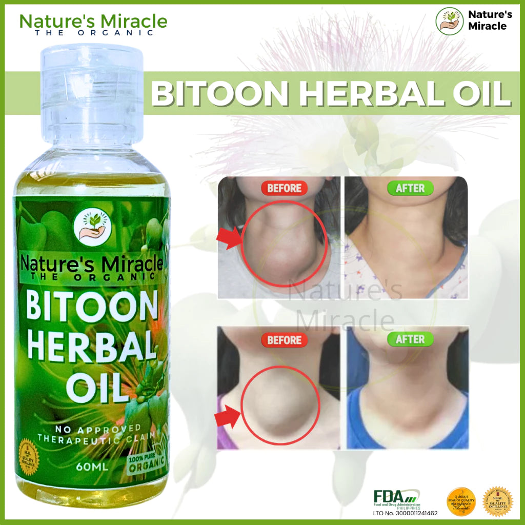 Bitoon Herbal Oil Bitoon Oil Original Bitoon Herbal Oil Original Tunaw ang Bukol Goiter Cyst Tumor