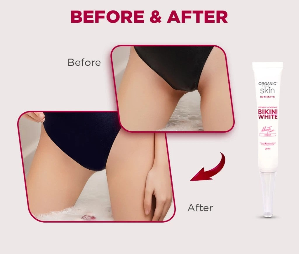 Organic Skin Japan Bikini Whitening Cream Inner Thigh Intimate Area Lightening Cream 20ml